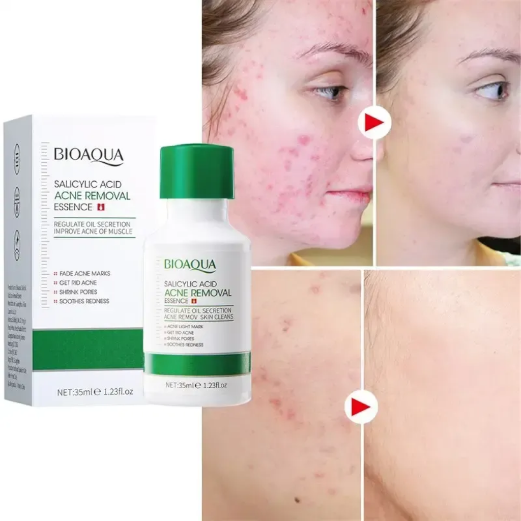 Serum Anti Acné con Ácido Salicílico Reparador de Poros de Bioaqua Esencia